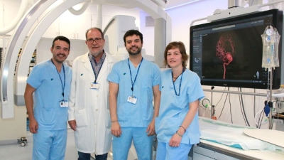 Primera operación en Cataluña de un aneurisma gigante pediátrico con técnica endovascular